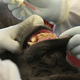 A sedated chimp being administered the oral vaccine at the New Iberia Research Center. (Image: Peter D. Walsh et al., 2017)
